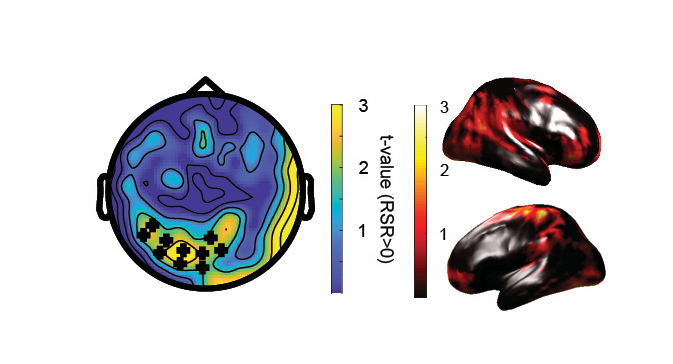 Sustained neural responses after rhythmic intelligible speech